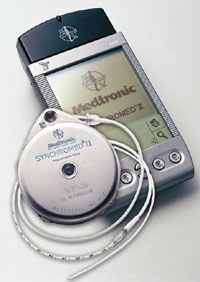 Medtronic Synchromed