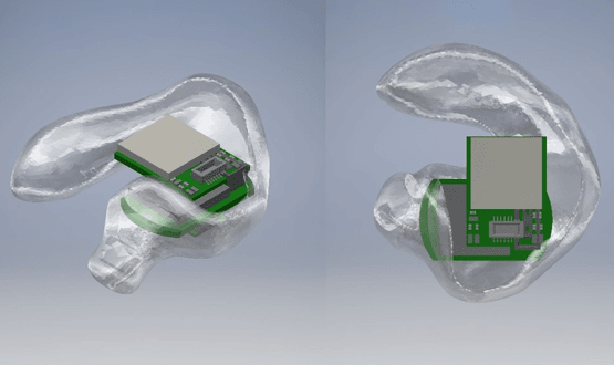 AN EEG device that fits in the ear could be used to monitor dementia patients' brain function