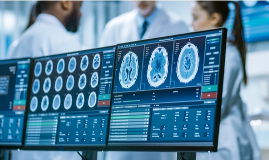 Mitigating a post-covid-19 surge on imaging departments with joined tech