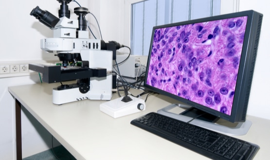 Digital pathology