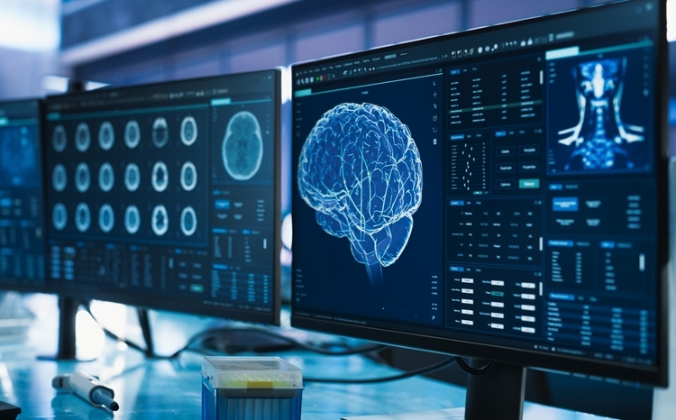 Cancer Research Center Medical Laboratory: Close Up of a Set of Desktop Computer Monitors Showing CT Scans Of Human Brain. Specialist Studying Brain