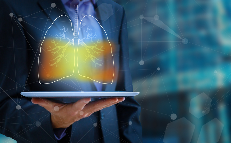 AI tool to help detect lung cancer deployed in Greater Manchester